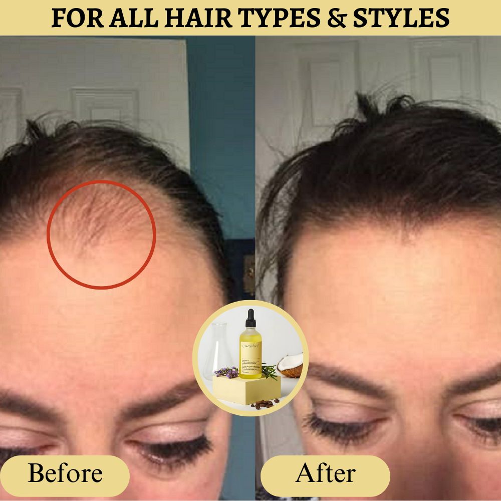 (+ Brush) Original Anti-Hair Loss Growth Veganic Serum