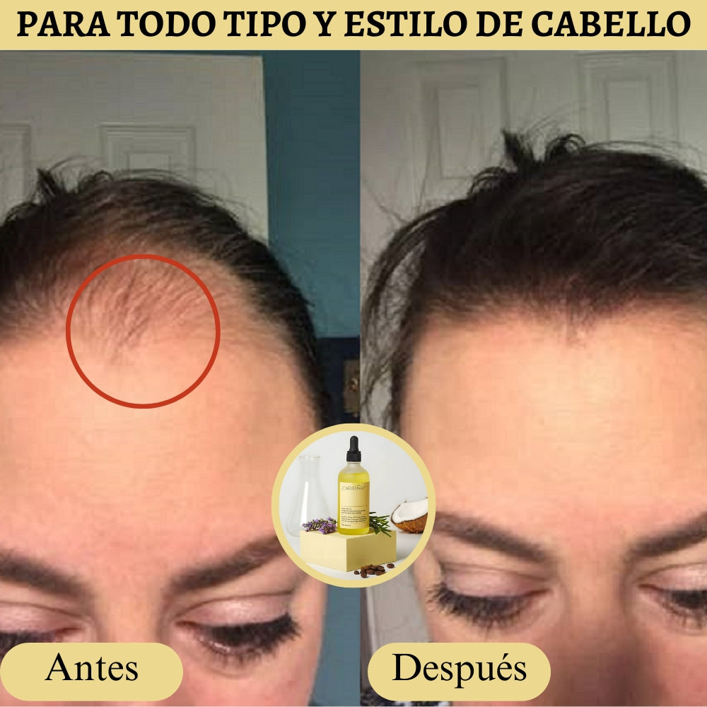 Producto Oficial Carvenchy Veganic Fórmula de 11 Aceites Naturales para el Crecimiento Capilar