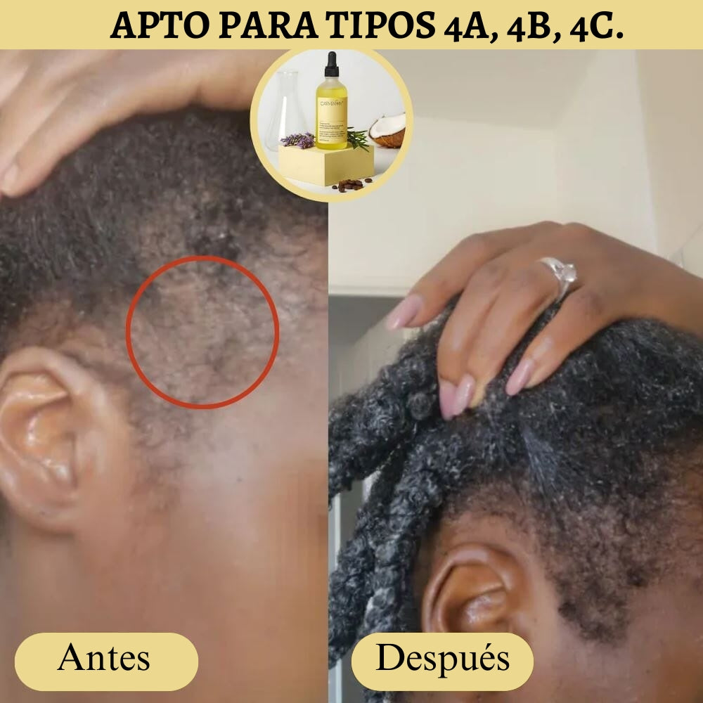 Producto Oficial Carvenchy Veganic Fórmula de 11 Aceites Naturales para el Crecimiento Capilar