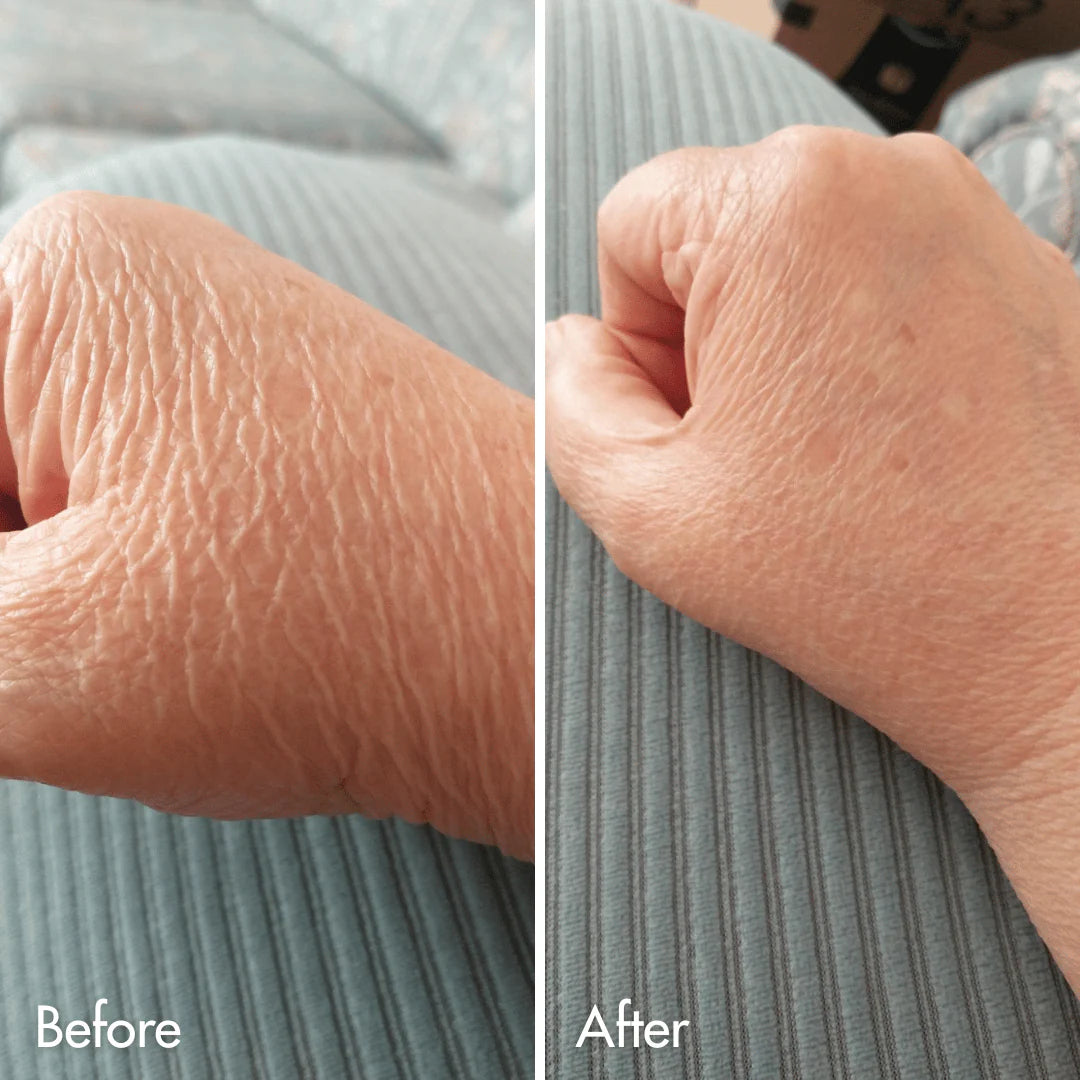 Crepey Skin Repair Treatment