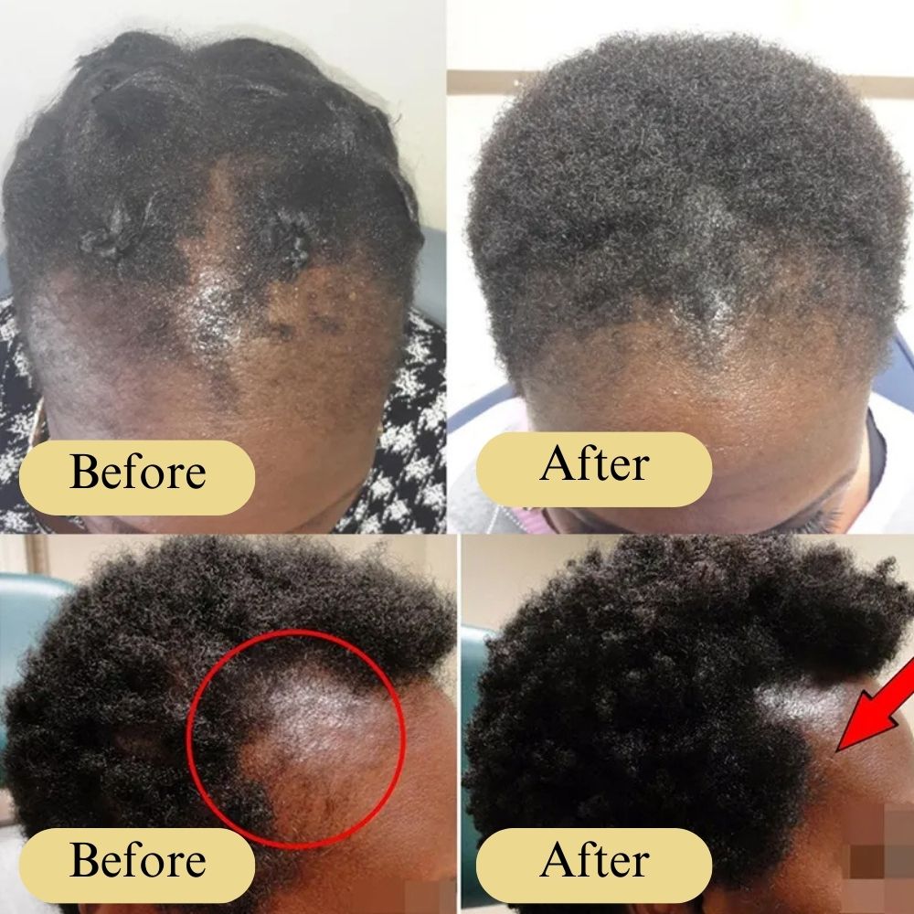 Carvenchy Veganic Natural Hair Growth Oil