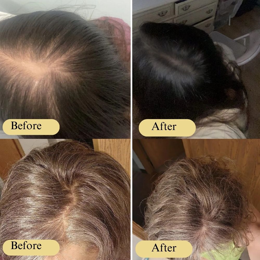 Natural Anti-Hair Loss Growth Serum