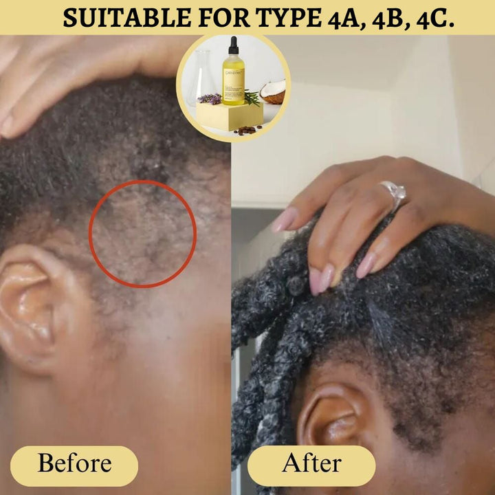(+ Brush) Original Anti-Hair Loss Growth Veganic Serum