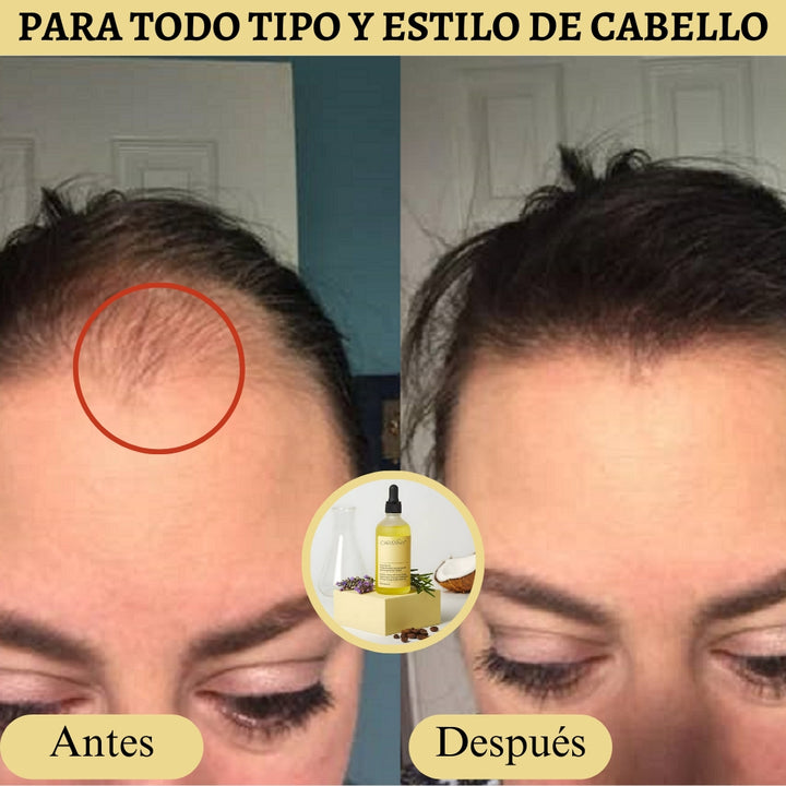 Producto Oficial Carvenchy Veganic Fórmula de 11 Aceites Naturales para el Crecimiento Capilar