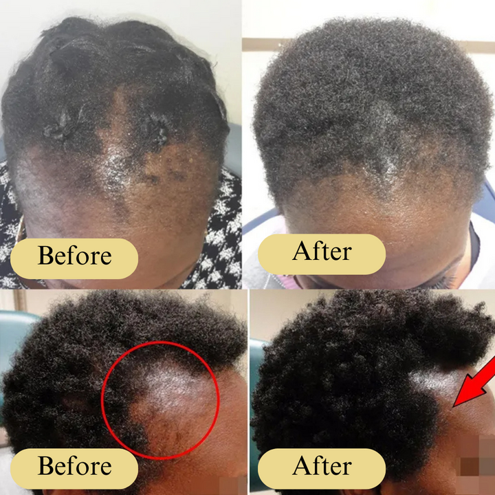 (+ Brush) Original Anti-Hair Loss Growth Veganic Serum