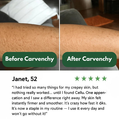 Crepey Skin Repair Treatment